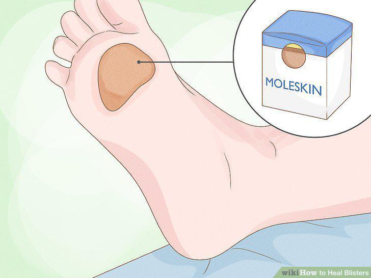 Step 20