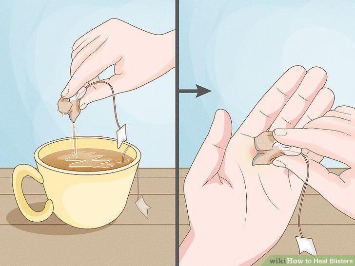 Step 9
