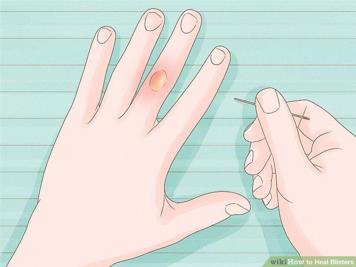 Step 10