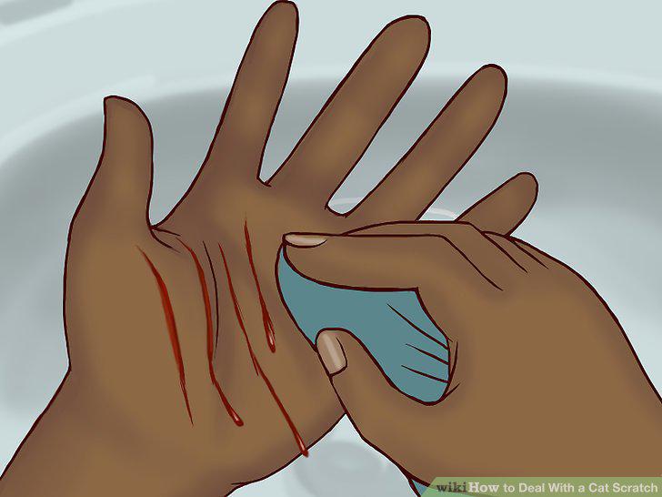 Step 11