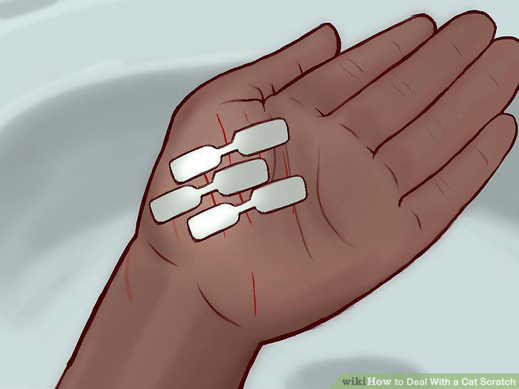 Step 14