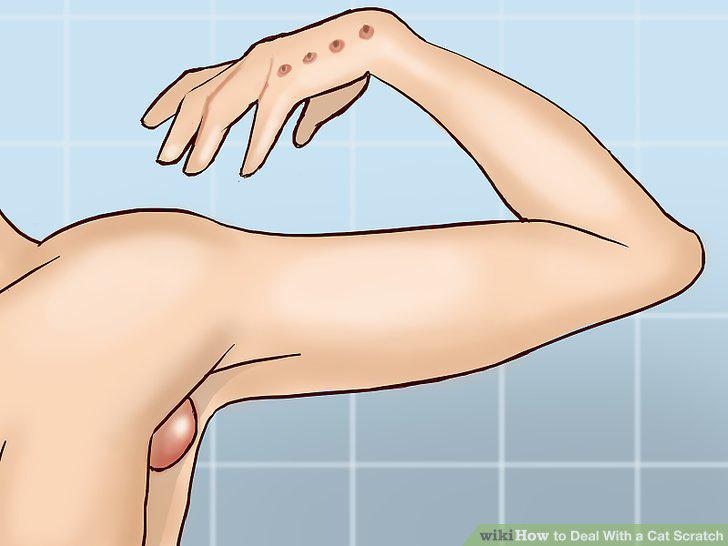 Step 16