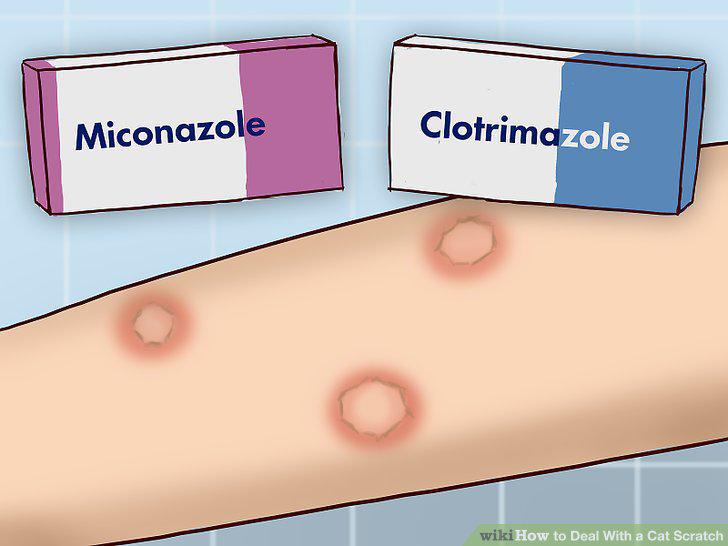 Step 17