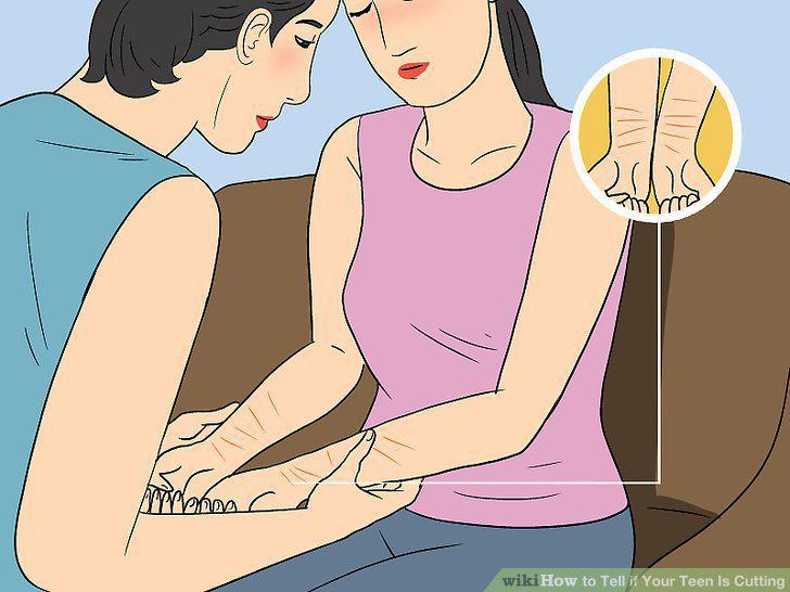 Step 15