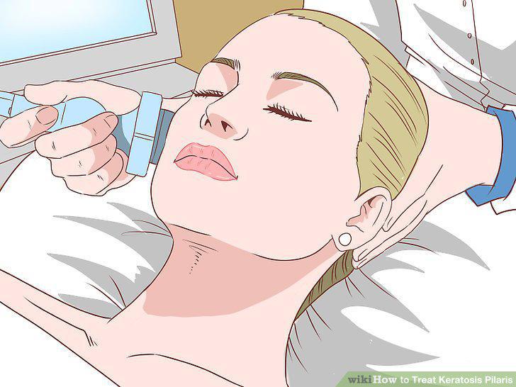 Step 12
