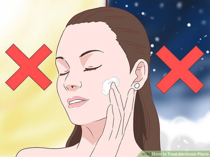 Step 8