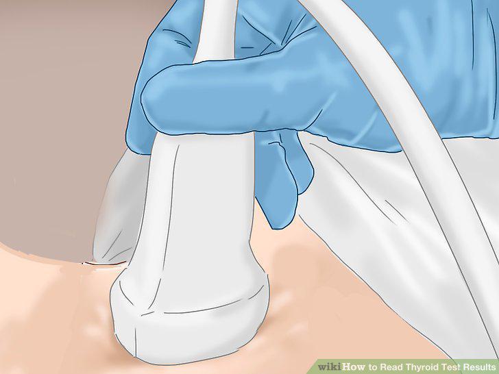 Step 13