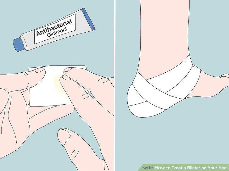 Step 11