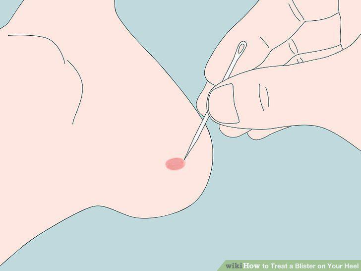 Step 9