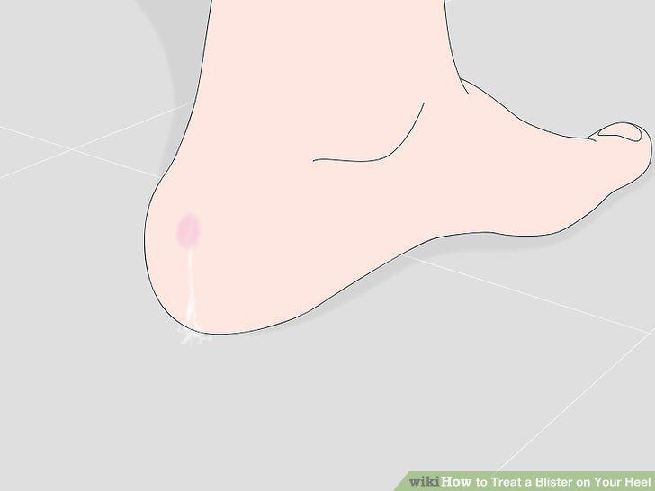 Step 10