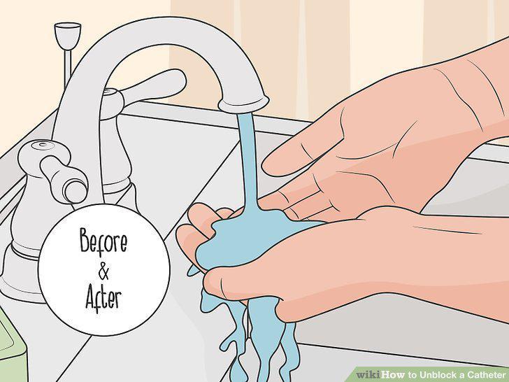 Step 14