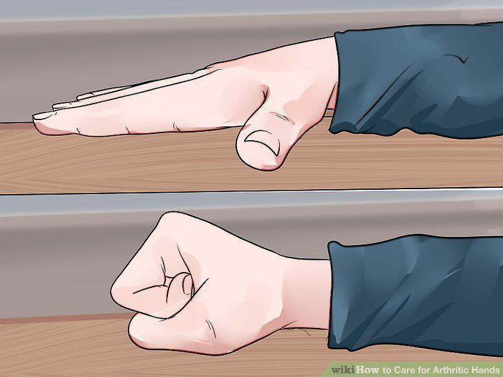 Step 13