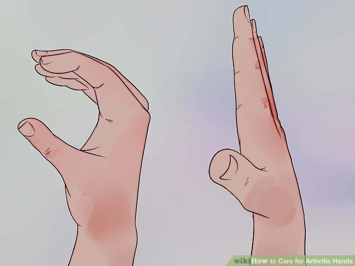 Step 14