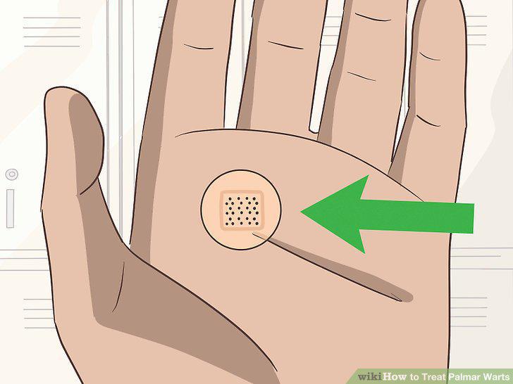 Step 11