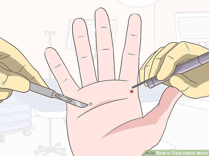 Step 9