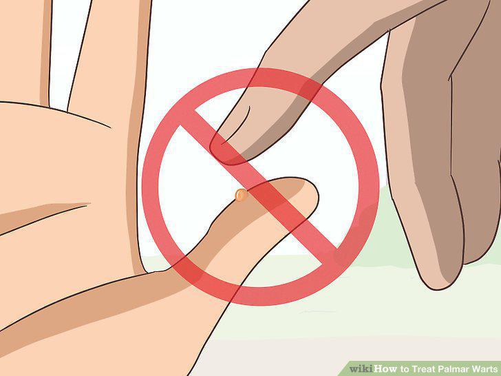 Step 10