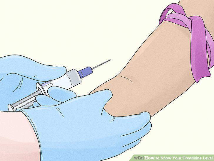 Step 13