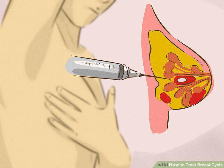 Step 10