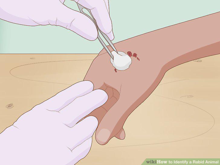 Step 11