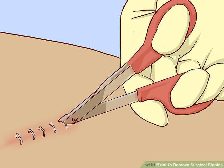 Step 2