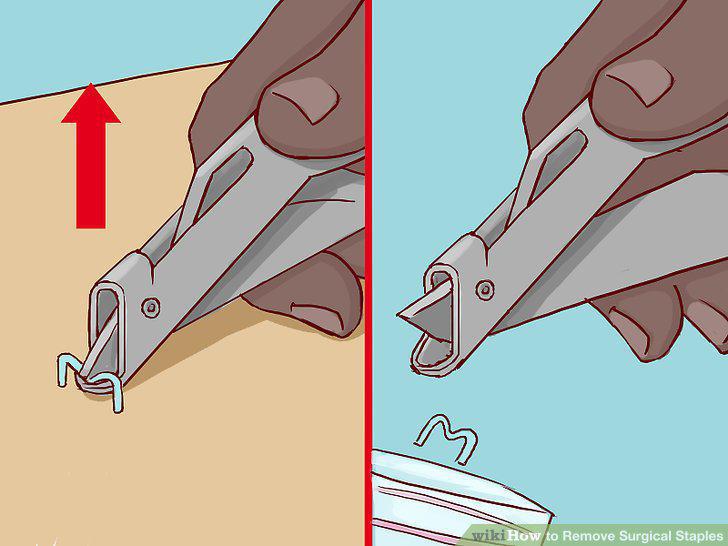 Step 4