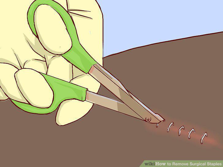 Step 5