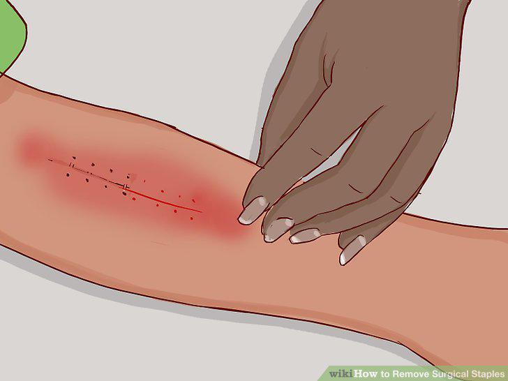 Step 8