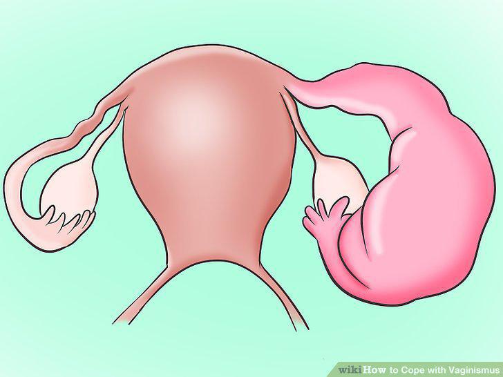 Step 12