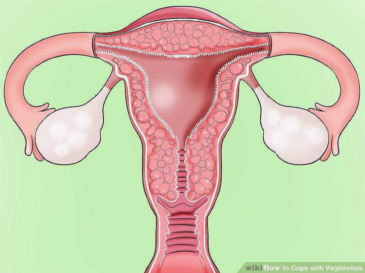 Step 13