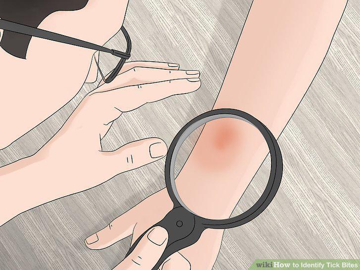 Step 10