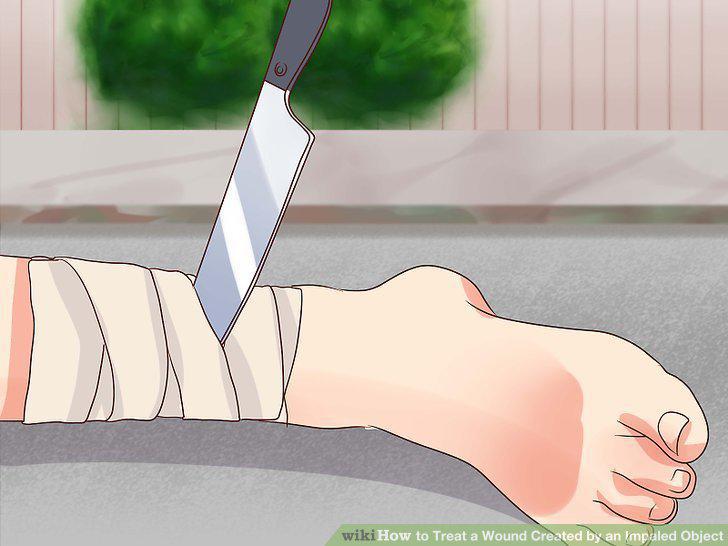 Step 2