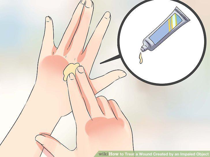 Step 11
