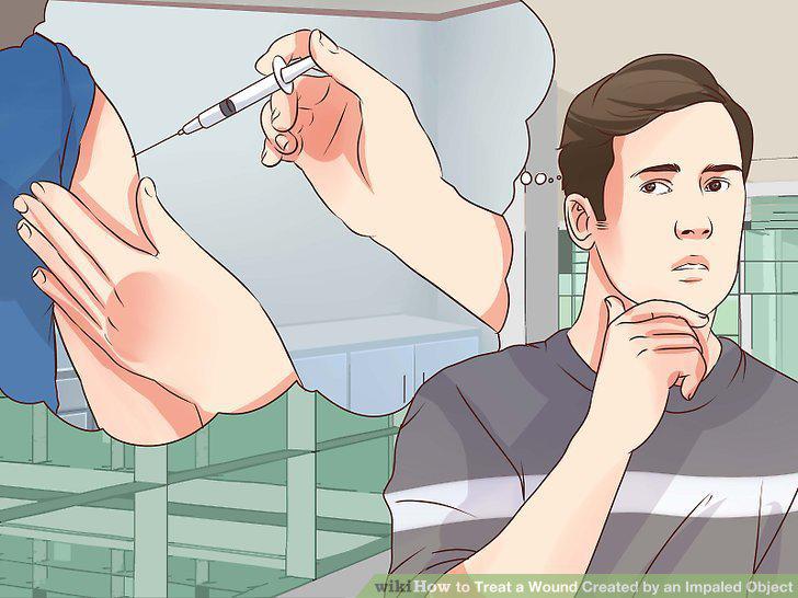 Step 12