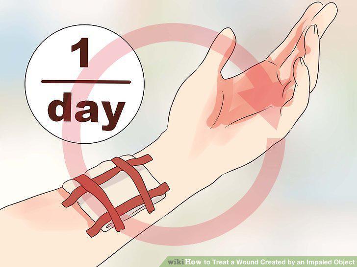 Step 14