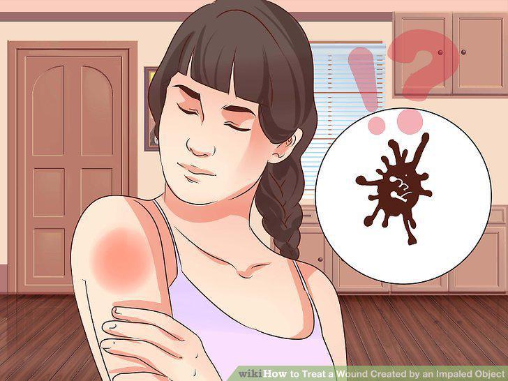 Step 15