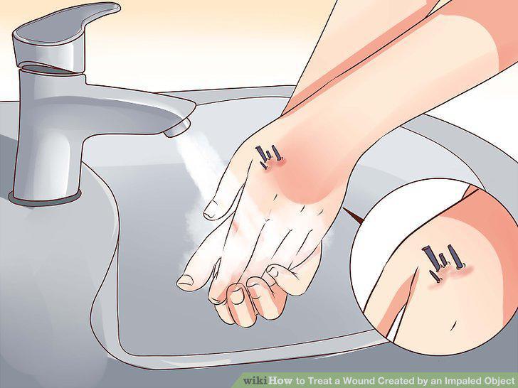 Step 7