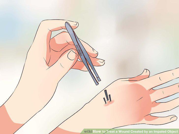 Step 9