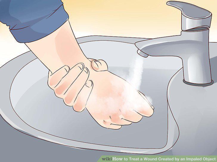 Step 10