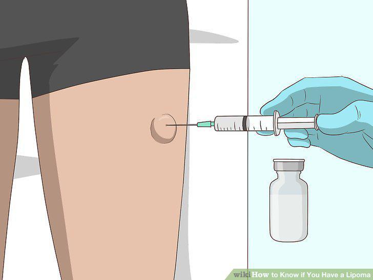 Step 12