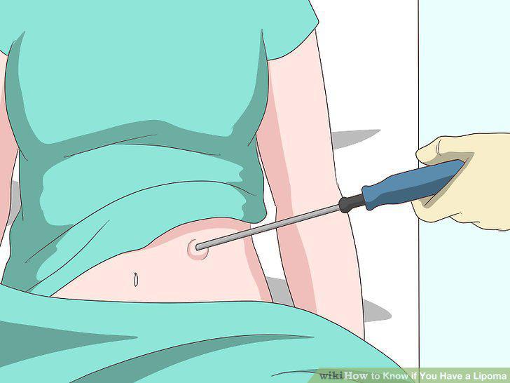 Step 14
