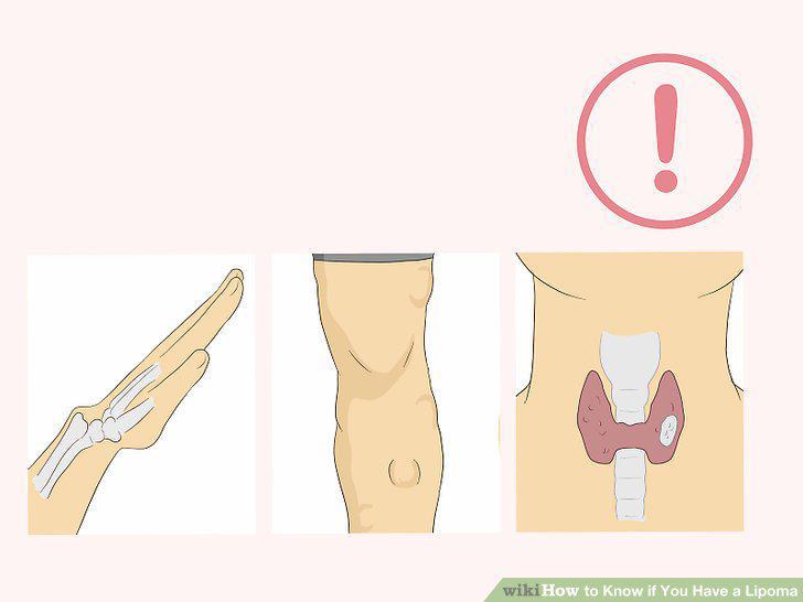 Step 9