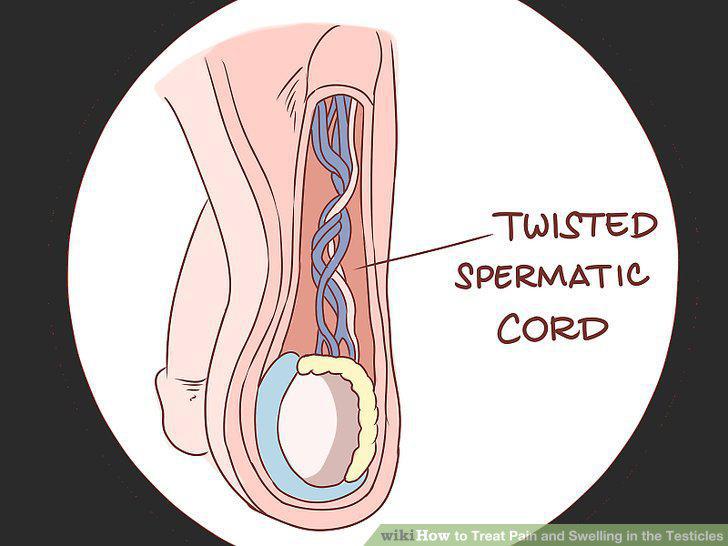 Step 14