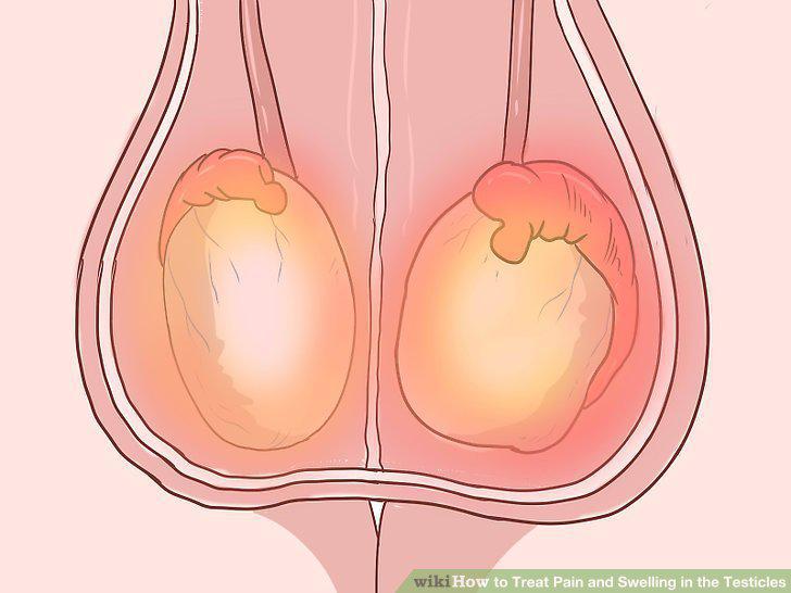 Step 10