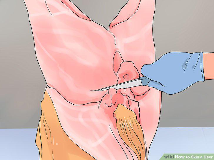 Step 11