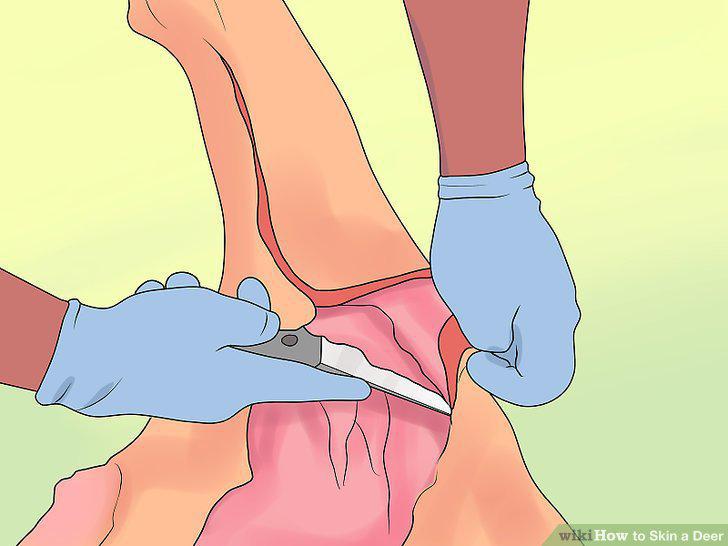 Step 5