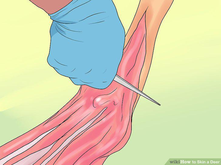 Step 6