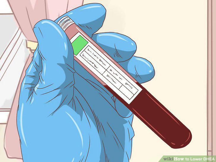 Step 14