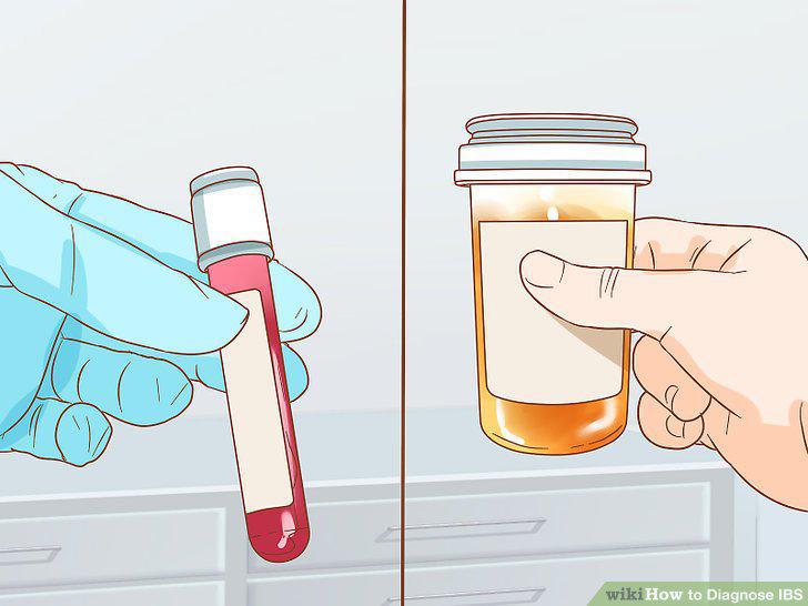 Step 10