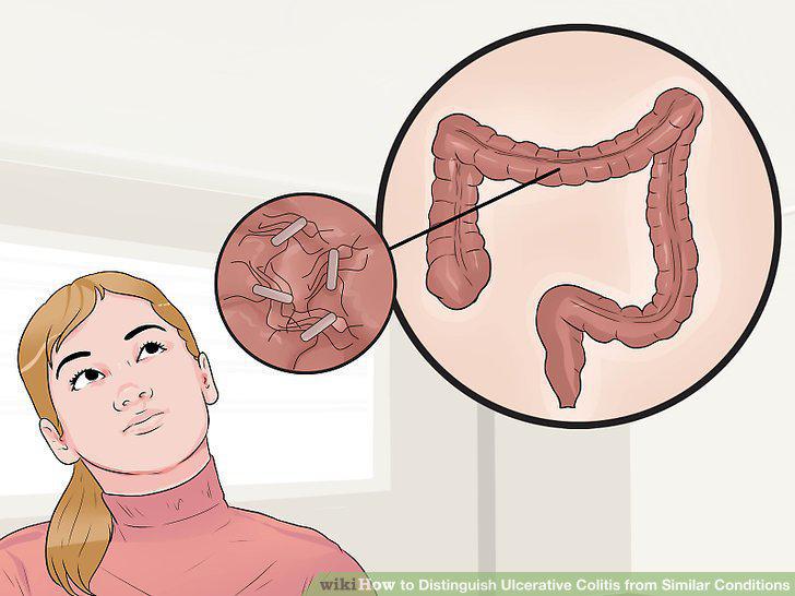 Step 10