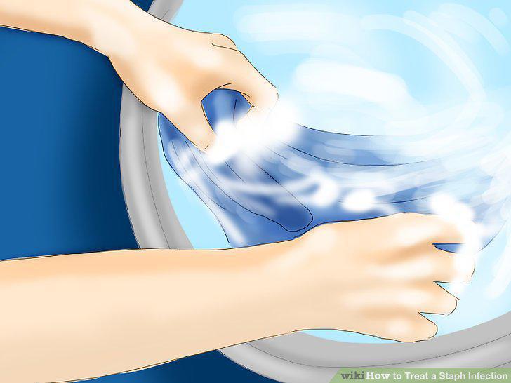 Step 14